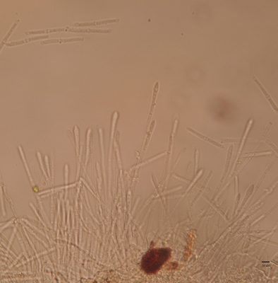 Vesicles and conidia of Calonectria pseudonaviculata, the causal agent of boxwood blight; Photo Credit: E. Bush