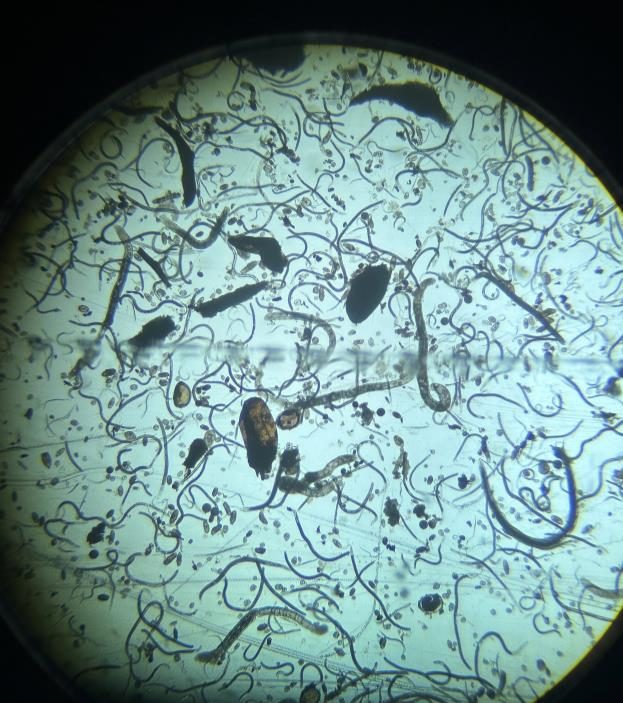 A microscope view of lance nematodes.